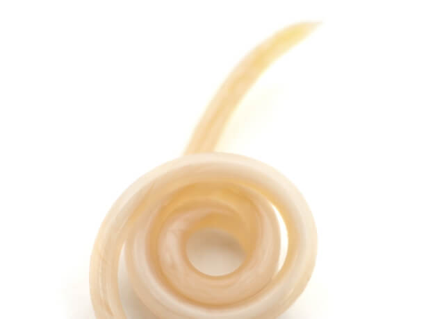 Image of a roundworm up close